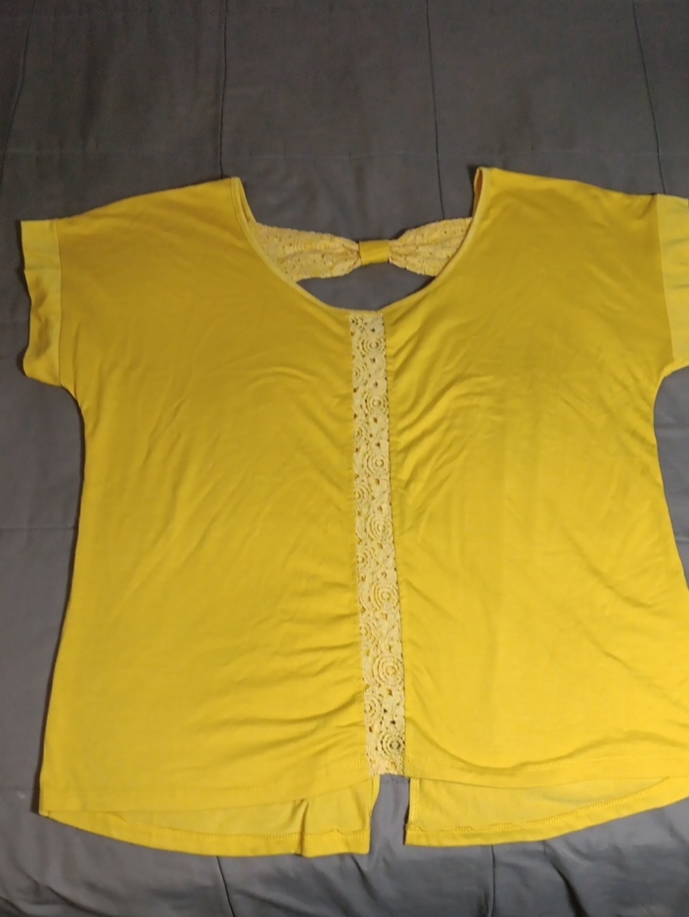 Bright Yellow Lace-Trim Short Sleeve Top